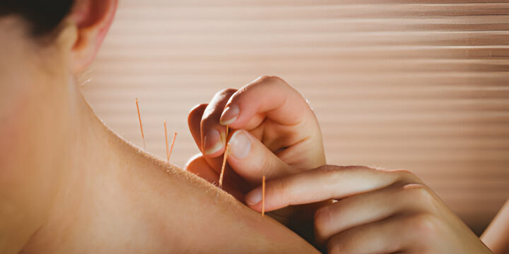 What to Expect During Your First Acupuncture Session